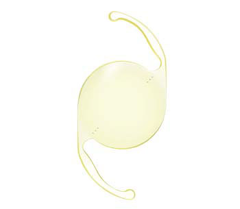 Clareon&reg; Toric IOL