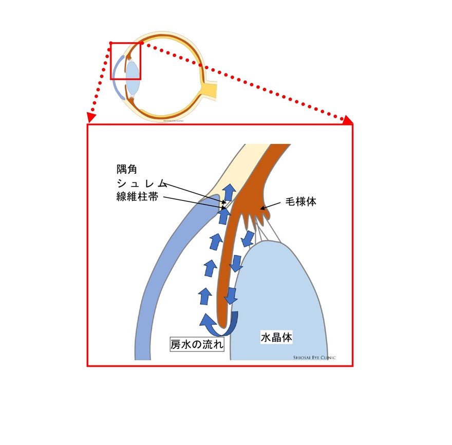 緑内障の症状