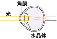 遠視：遠視の目に光が入った様子