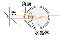 乱視：乱視の目に光が入った様子