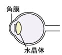 ICL
